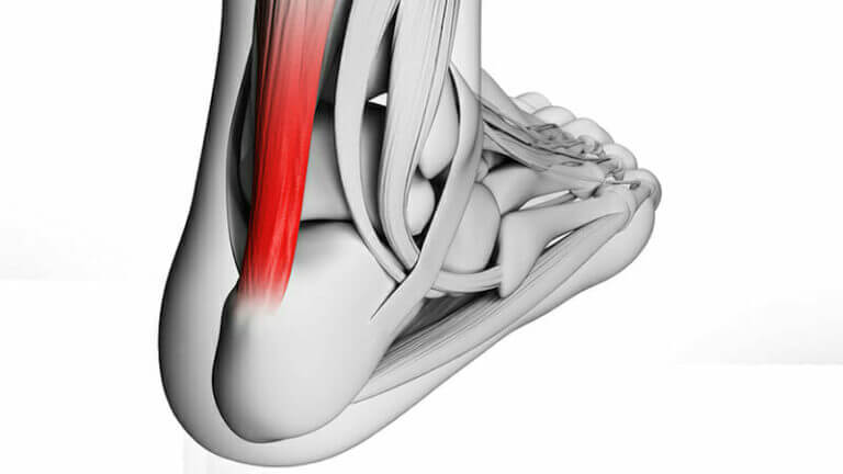The Best Shoes For Insertional Achilles Tendinitis